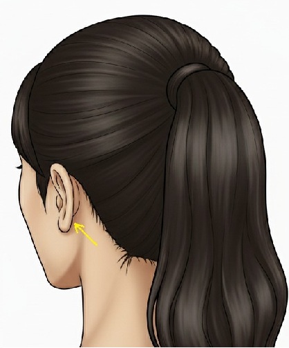 point acouphène derrière le lobe de l'oreille